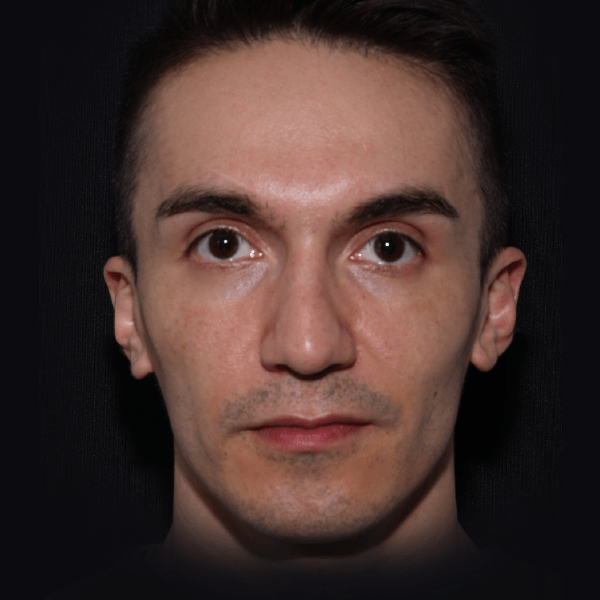 foto_perfilado_mandibular